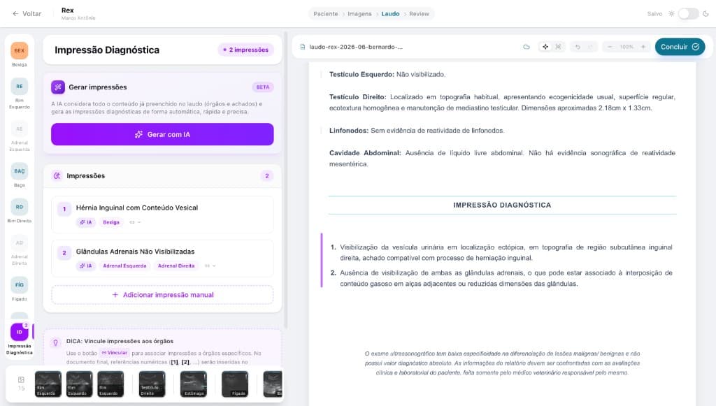 Editor de laudo de ultrassom com impressões diagnósticas geradas por IA e preview do documento